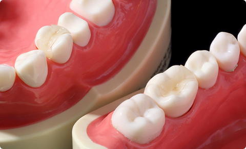 恵比寿の⻭医者・矯正歯科「ココロデンタル恵比寿」|セラミック歯科治療