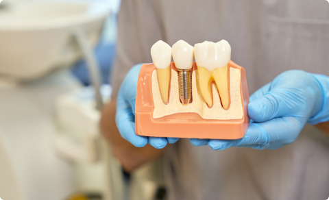 恵比寿の⻭医者・矯正歯科「ココロデンタル恵比寿」|インプラント治療